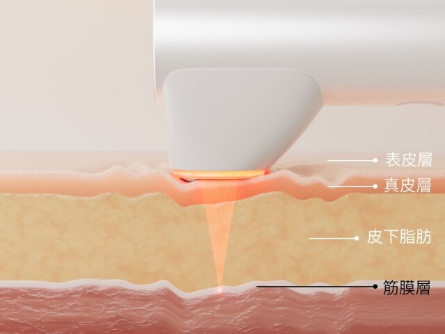MEDICUBE AGE-R HIGH FOCUS SHOT：BAZAAR FAB 2025「BEST AT-HOME DEVICE」