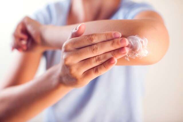 10 款濕疹藥膏、沒有類固醇皮膚敏感軟膏推介！適合面、手部、頭皮消炎止痕
