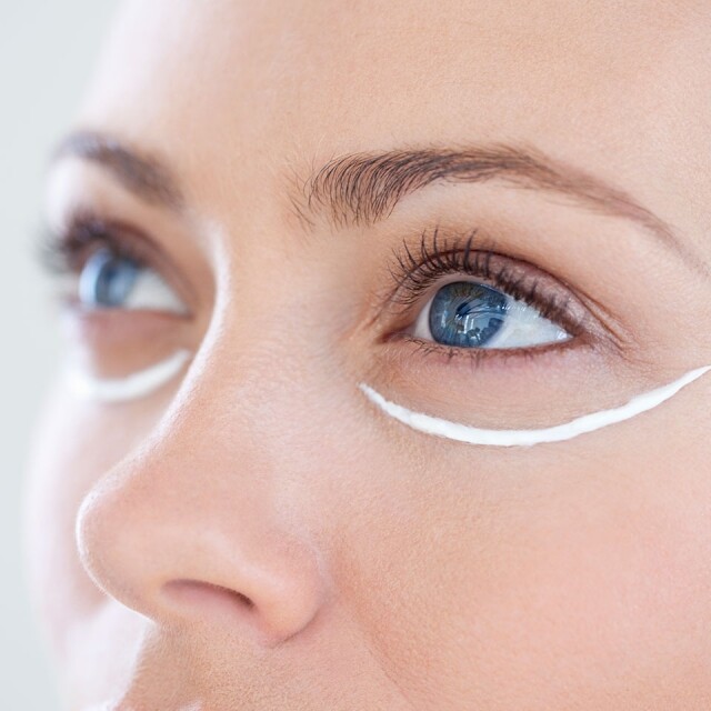 眼紋 眼部皮膚只有 0.3mm，加上經常眨眼或表情動作，眼部皮膚容易形成細紋，加上眼周膠原蛋白開始流失，特別容易出現在眼頭、眼尾等位置。若眼部皮膚乾燥，眼紋的情況會更嚴重，故塗眼霜及敷眼膜是最佳的保養法。
