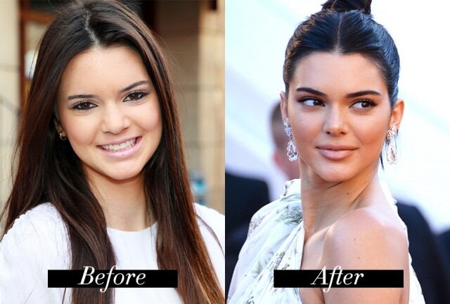 Kendall Jenner 眉毛前後不同