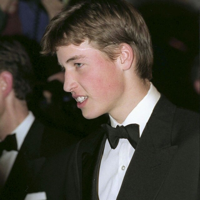 巧合的是,Prince William 在額頭上也有一道清晰可見的疤痕。 巧合的是,Prince William 在額頭上也有一道清晰可見的疤痕。