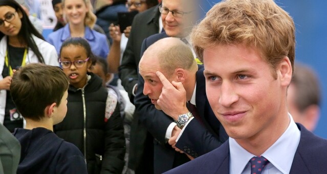 Prince William 前額的 Harry Potter Scar 是與 Kate Middleton 的另類巧合？