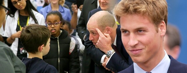 威廉王子前額的 Harry Potter 疤痕是與 Kate Middleton 的甜蜜巧合？
