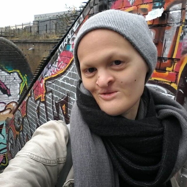 遺傳基因疾病模特兒踏上世界時裝舞台 遺傳基因疾病模特兒踏上世界時裝舞台